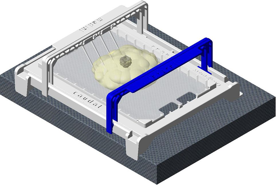 Positionierungshilfe für Aufnahme anterior-posterior (ap)