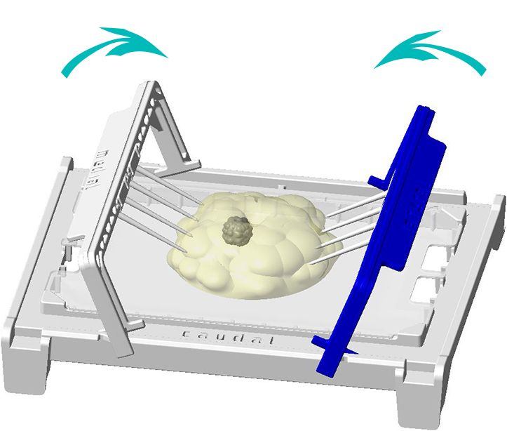 3. Montage Fixierungsbrücke