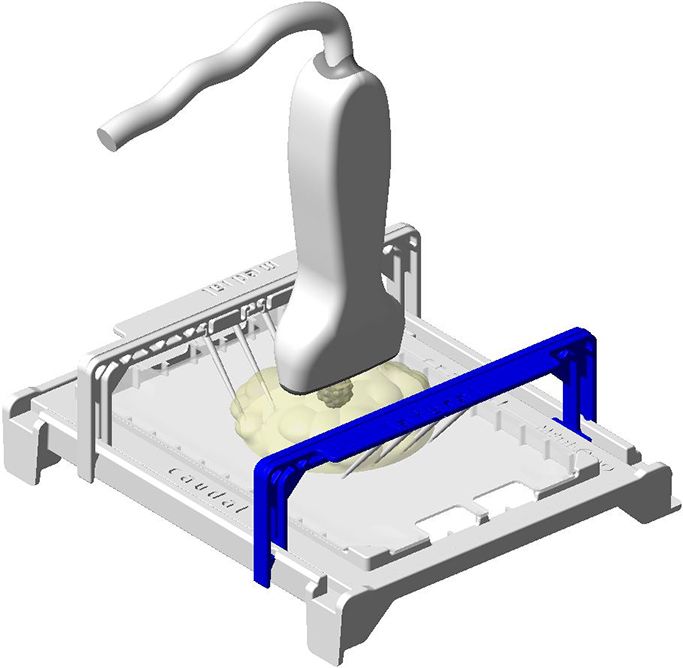 Präparat Sonographie