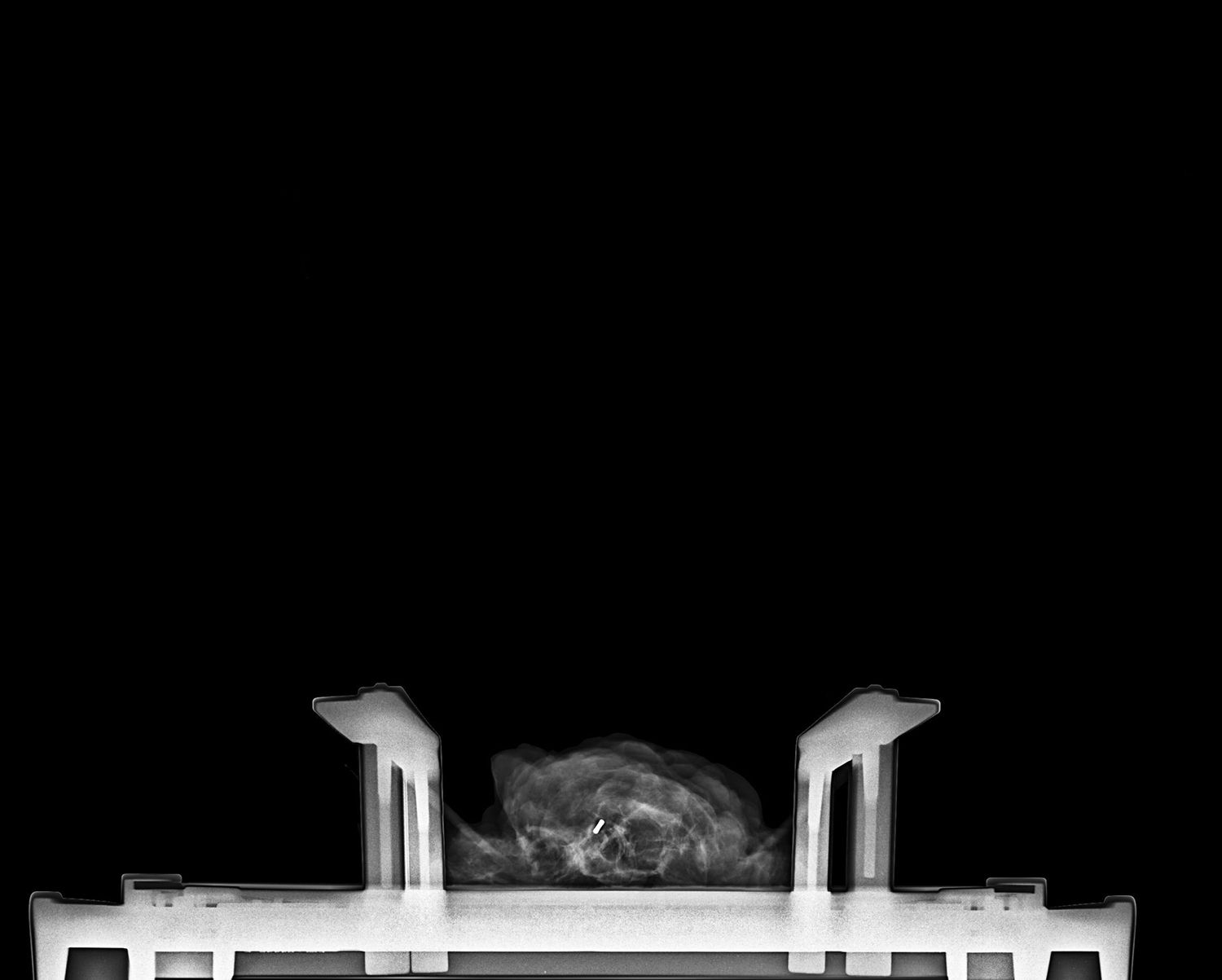 Präparat Radiographie mit Metalklip
