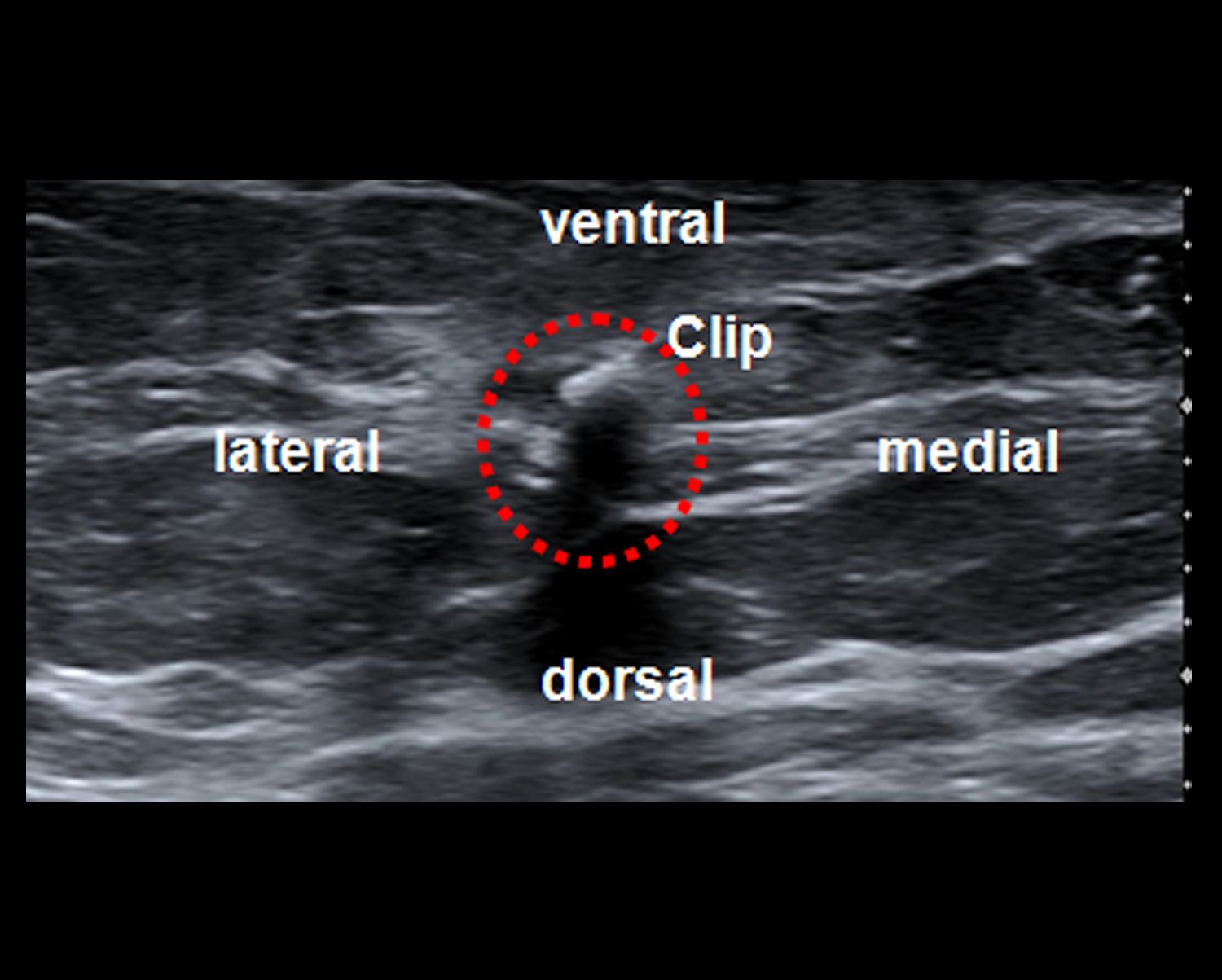 Sonografie
